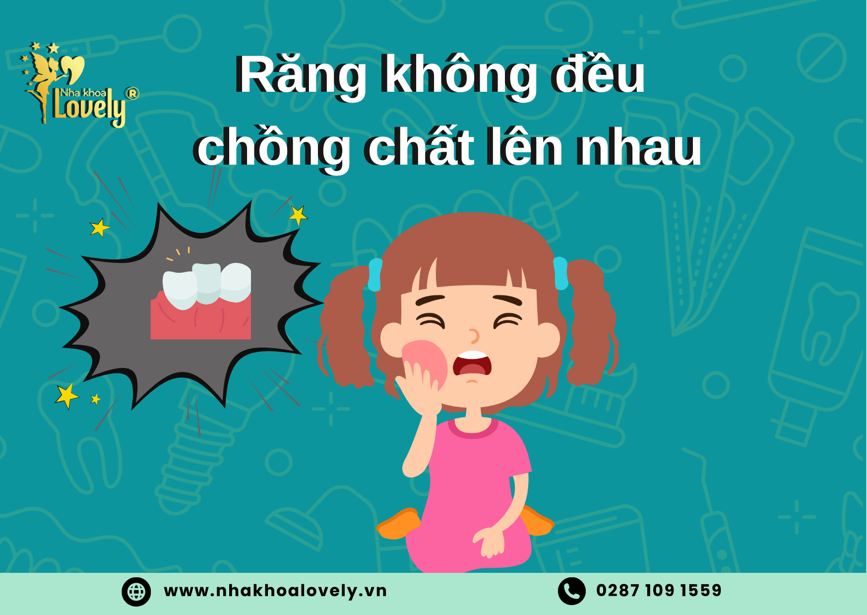 Răng không đều còn dẫn đến nguy cơ mất thẩm mỹ