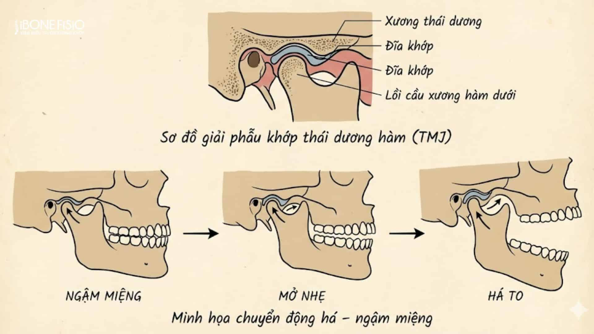 mức độ điều trị khớp thái dương hàm