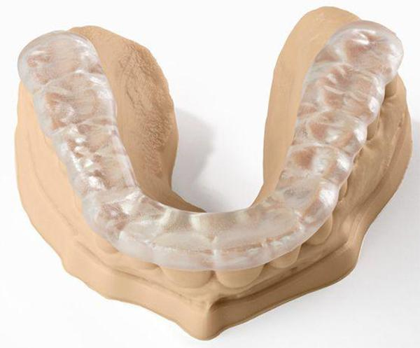 máng nhai khớp thái dương hàm giá bao nhiêu và cách dùng